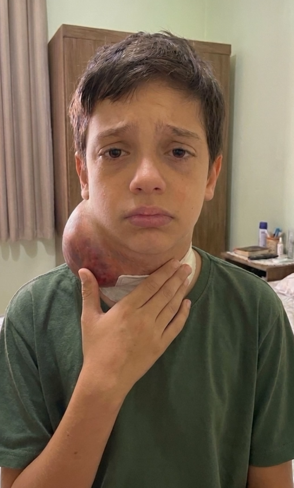 Daniel, um menino que enfrenta uma doença grave, com um caroço visível no pescoço